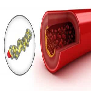 Lipid