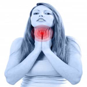 infectious-mononucleosis